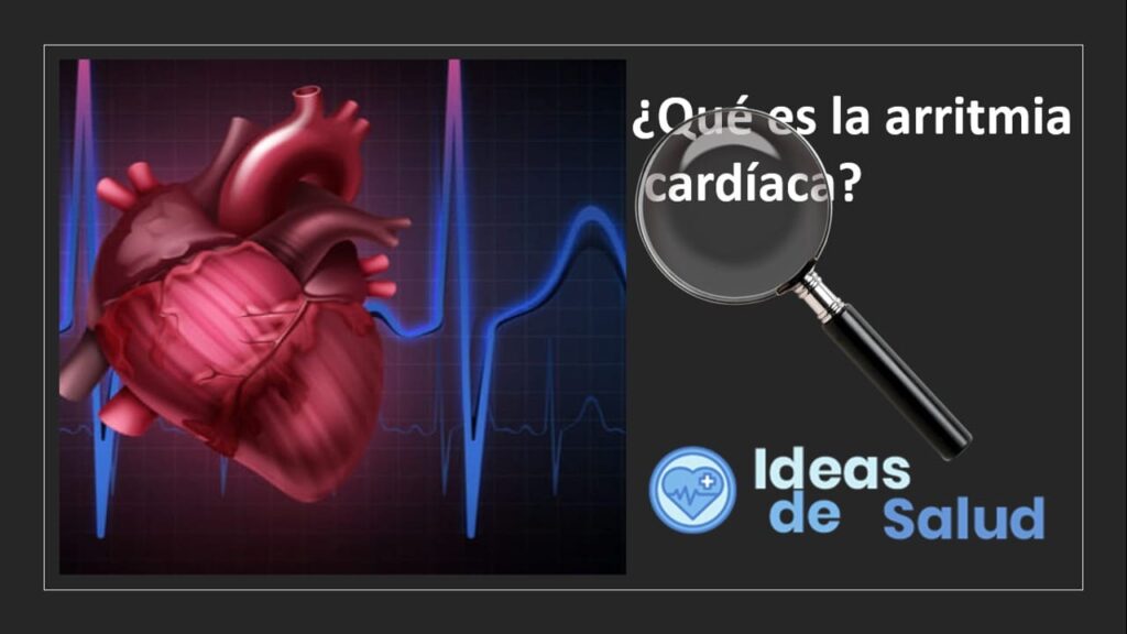 Cu Les Son Los S Ntomas De La Arritmia Card Aca Ideas De Salud