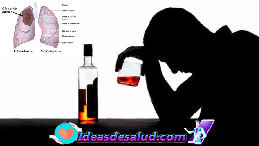 Cuáles son los tipos de cáncer que puede desencadenar el consumo de alcohol