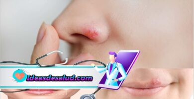 Remedios caseros del herpes de la nariz