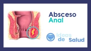Absceso anal