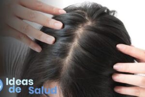 ¿Cuál es el tratamiento para la foliculitis en el cuero cabelludo?