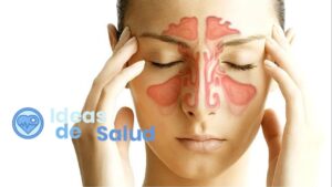 ¿Cuáles son los principales síntomas de la sinusitis?
