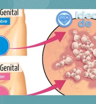 ¿Cuáles son los principales síntomas del herpes genital?