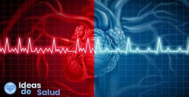 ¿Cuáles son los síntomas de la arritmia cardíaca?