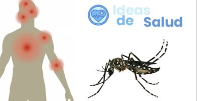 ¿Cuáles son los síntomas del dengue?