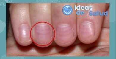 Dolor de uñas, ¿Qué puede ser y qué debe hacerse?