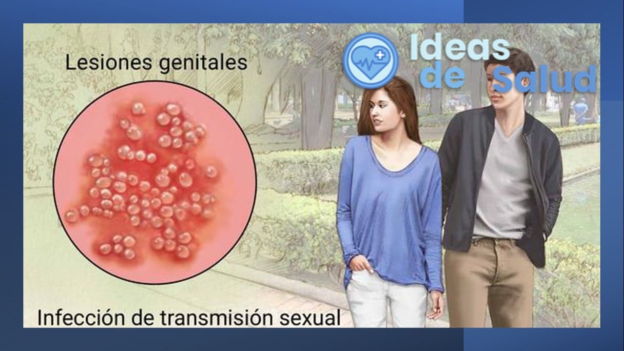 ¿cuáles Son Los Principales Síntomas Del Herpes Genital 🥇【2024 】 Ideas De Salud