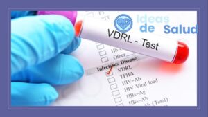 ¿Qué significa el test VDRL?